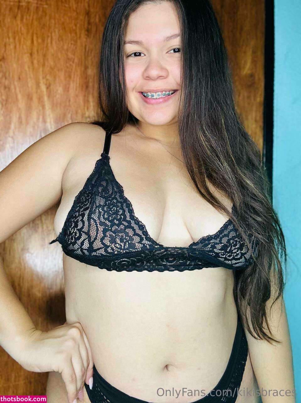 kikisbraces Nude OnlyFans Photos #2 1022059