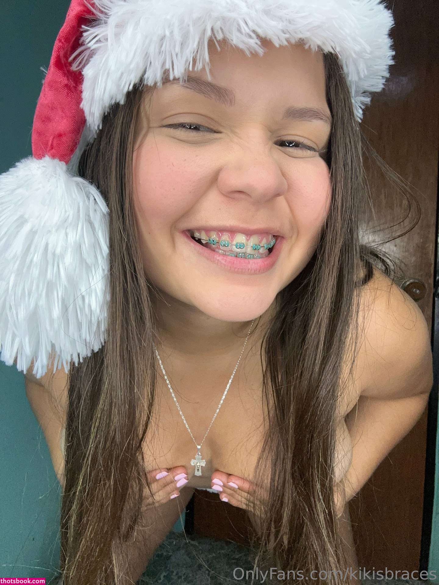 kikisbraces Nude OnlyFans Photos #6 1022092