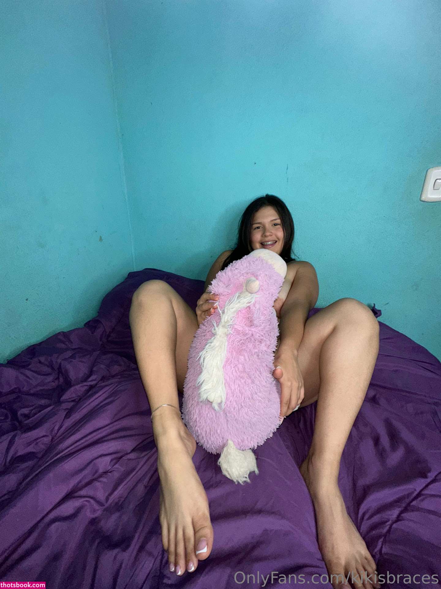 kikisbraces Nude OnlyFans Photos #8 1023121