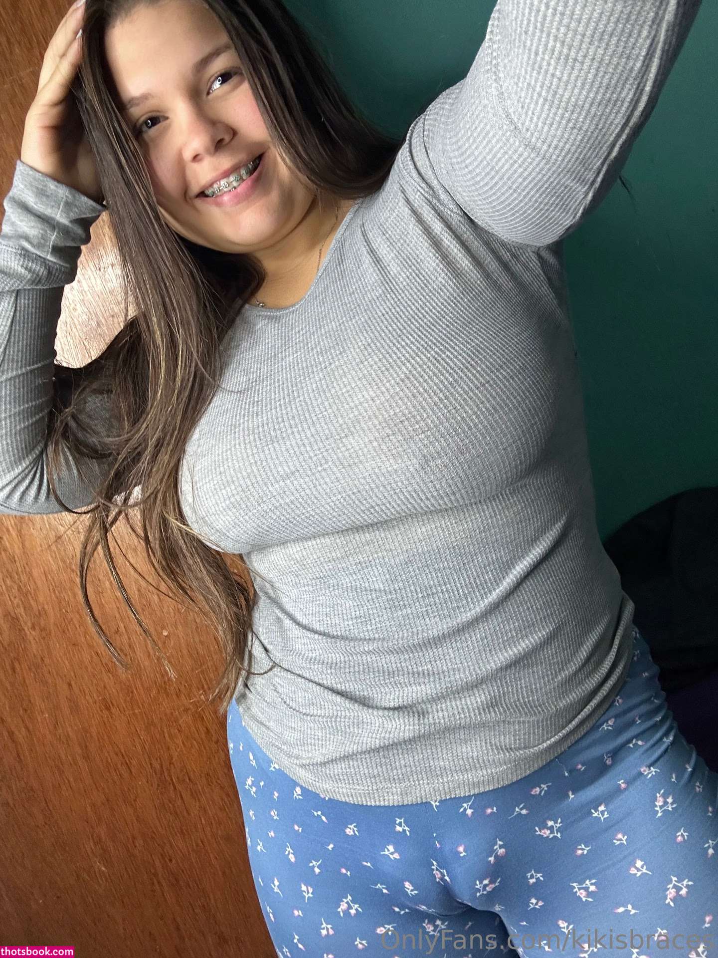 kikisbraces Nude OnlyFans Photos #10 1023140