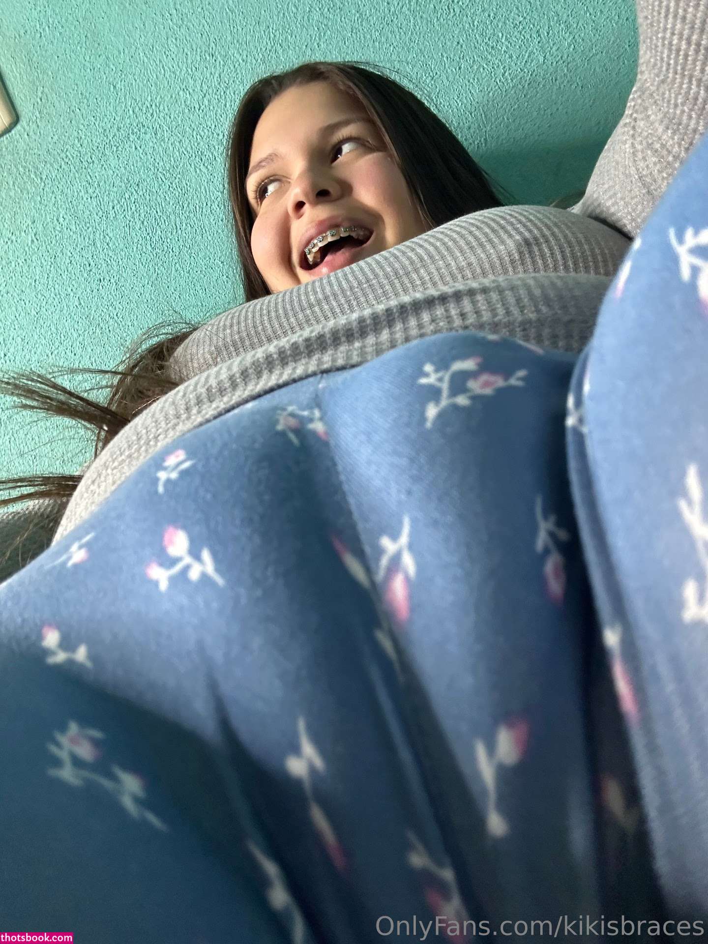 kikisbraces Nude OnlyFans Photos 10 Gallery - Ibradome