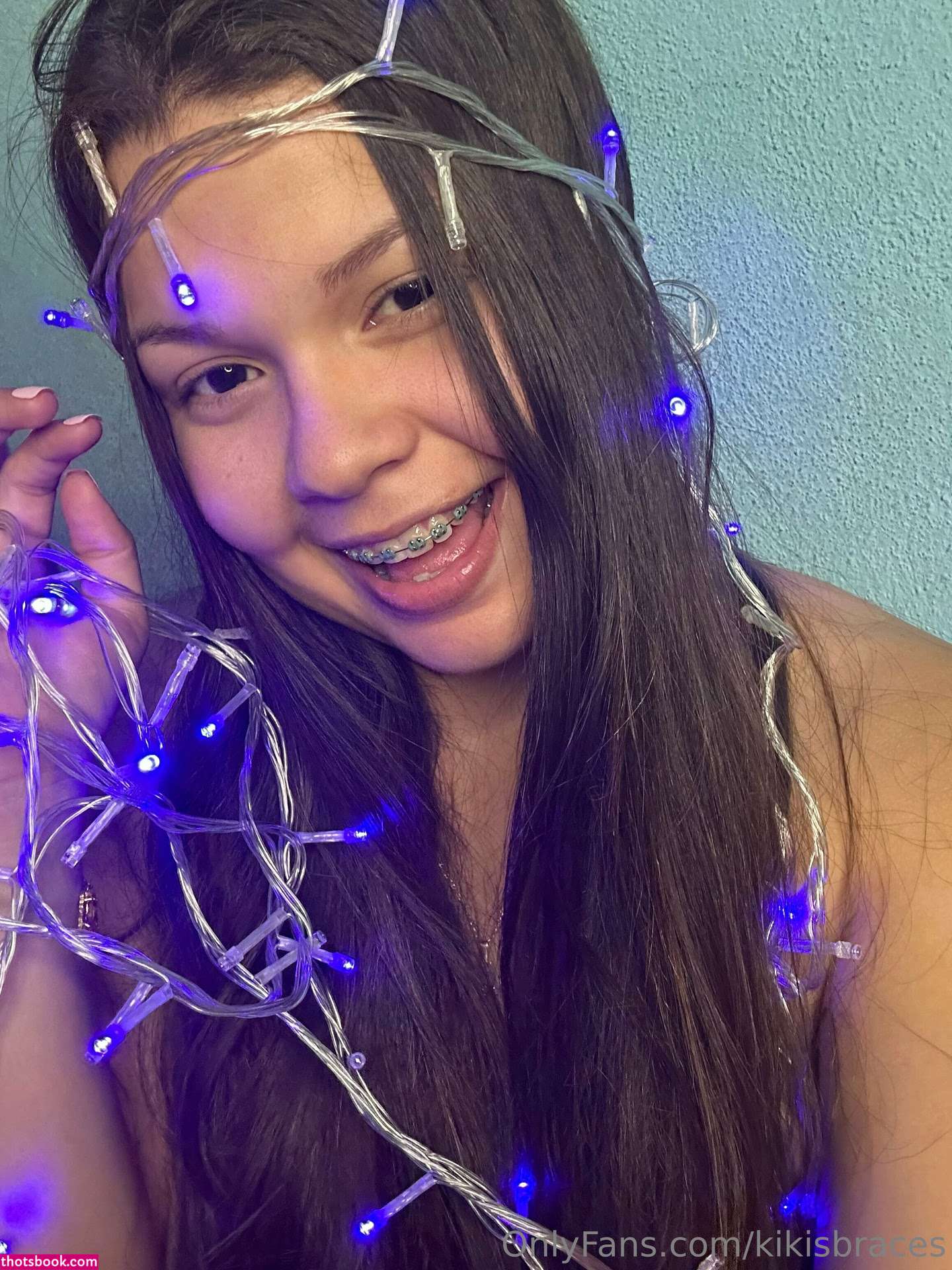 kikisbraces Nude OnlyFans Photos #11 1023145