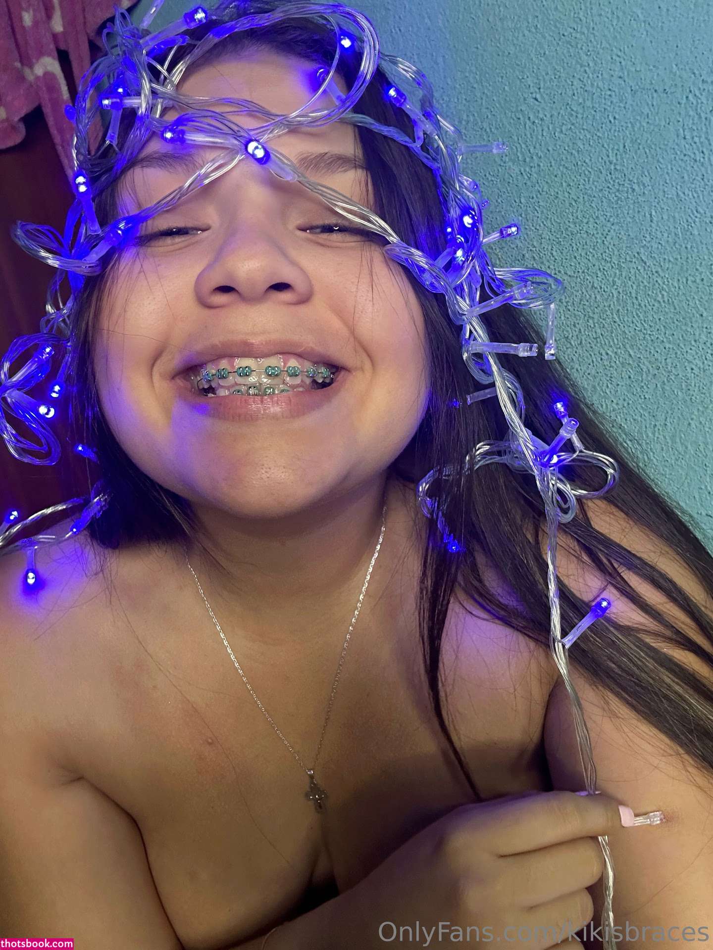 kikisbraces Nude OnlyFans Photos #11 1023146