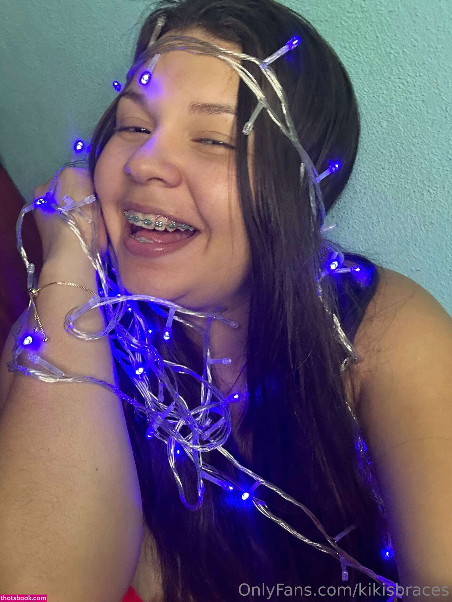 kikisbraces Nude OnlyFans Photos #11 1023147