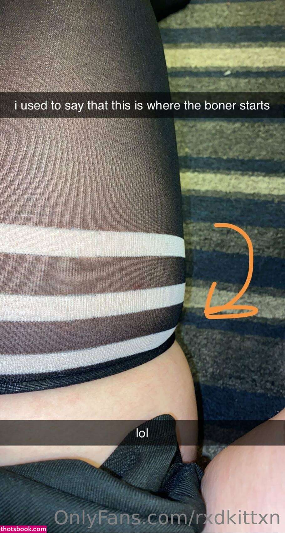 RxdKittxn Nude Leaks OnlyFans Photos #1 1338011