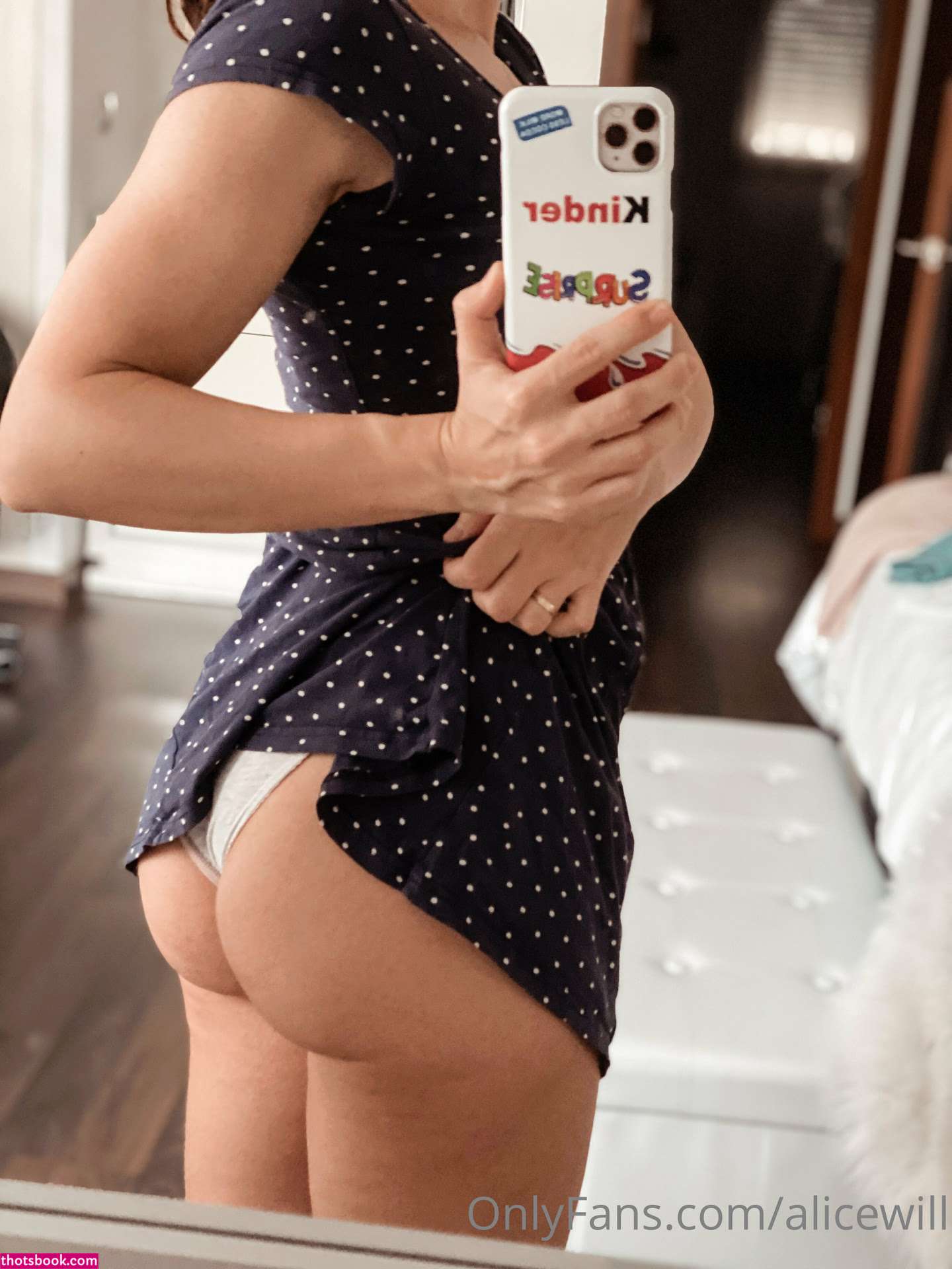 Alicewill Nude OnlyFans Photos #10 791291