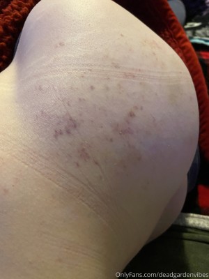 deadgardenvibes Nude Leaks OnlyFans Photos #5